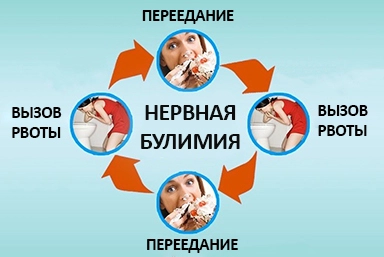 Лечение булимии в Курске